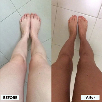 Elsovia® Transdermal Tanning Patch