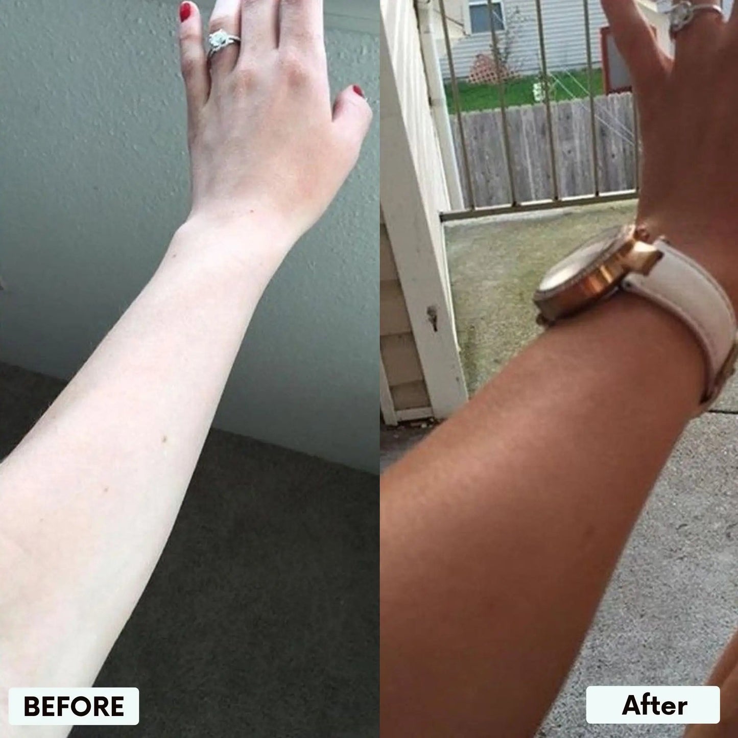 Elsovia® Transdermal Tanning Patch