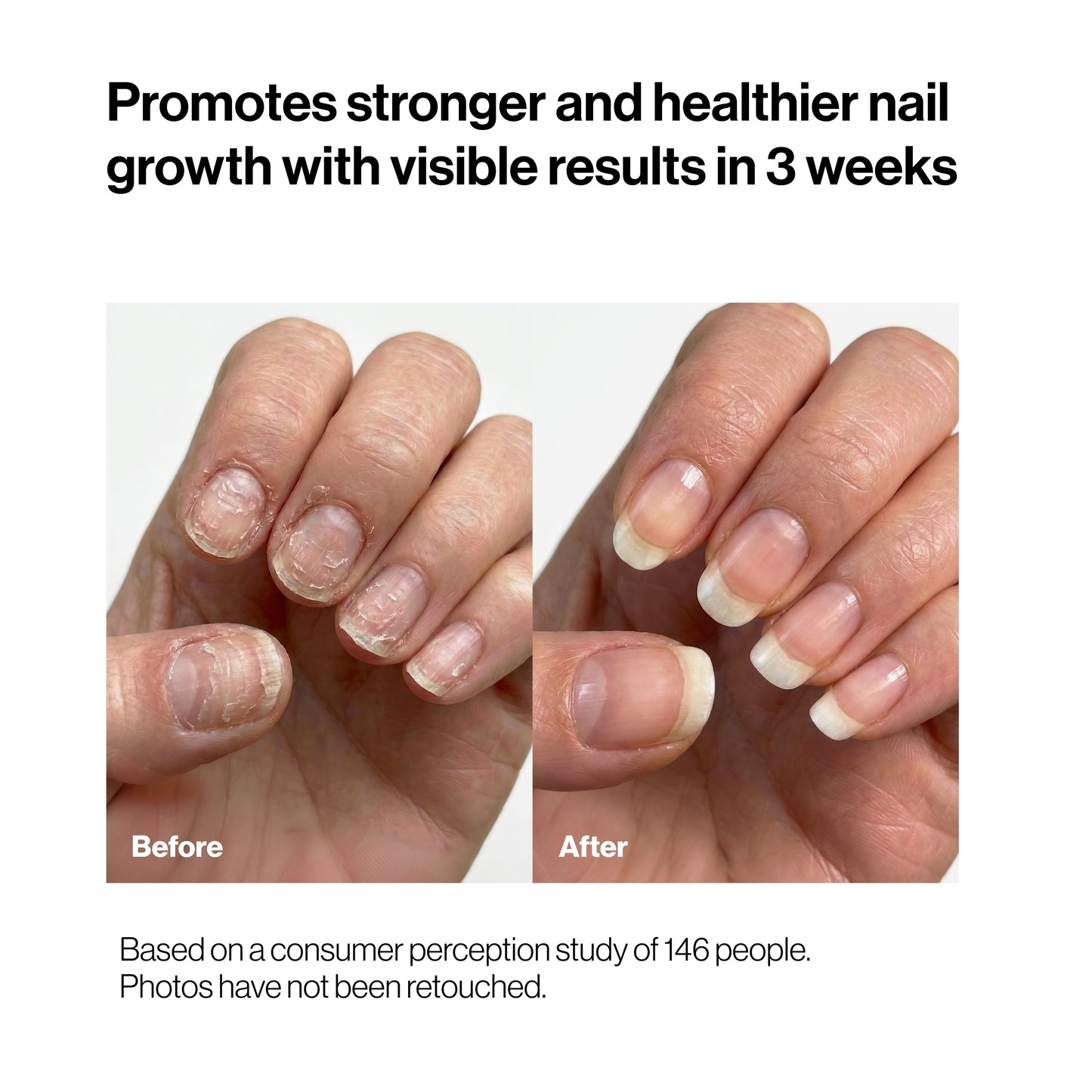 Nourishing Nail Pen | For Healthy & Strong Nails