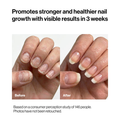 Nourishing Nail Pen | For Healthy & Strong Nails