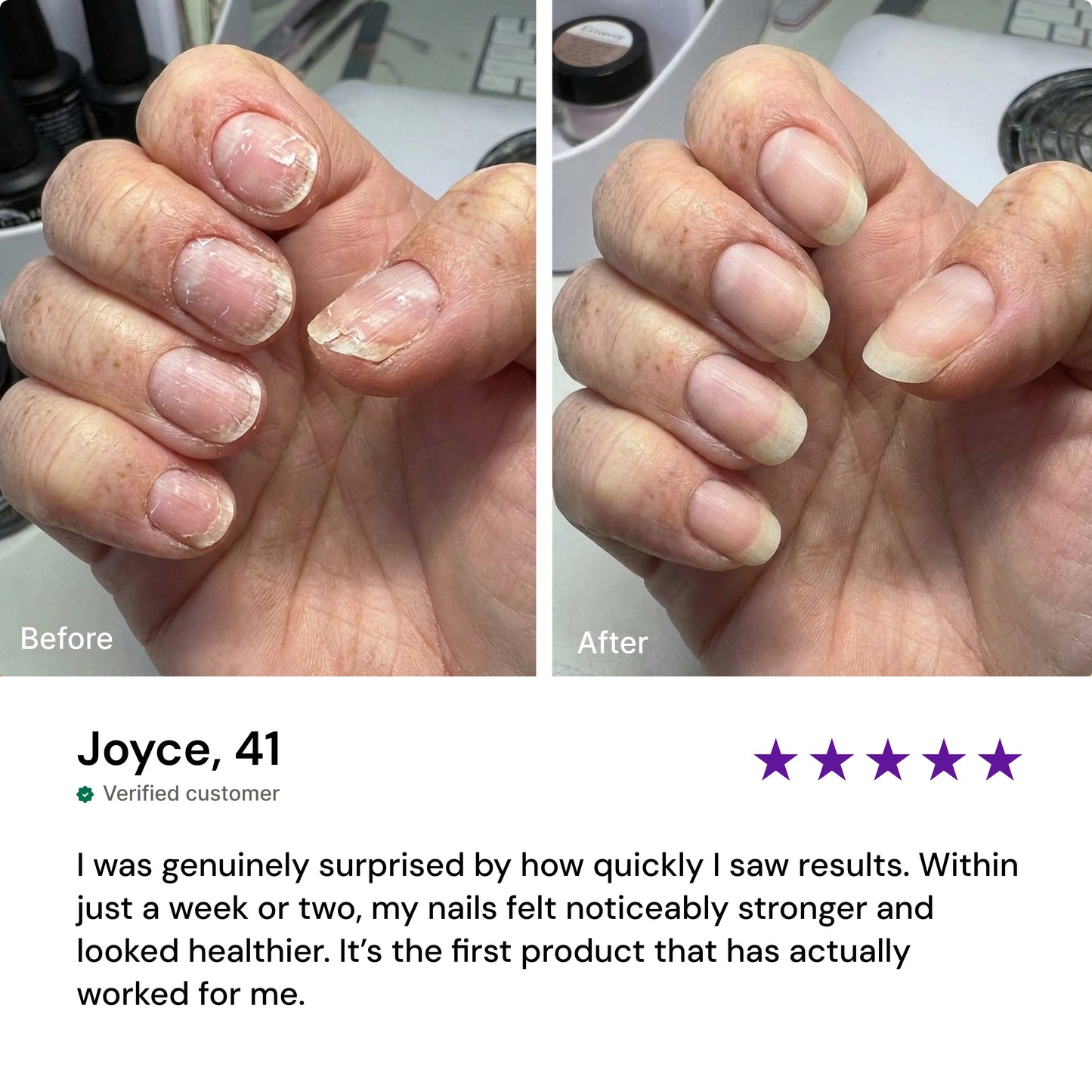 Nourishing Nail Pen | For Healthy & Strong Nails