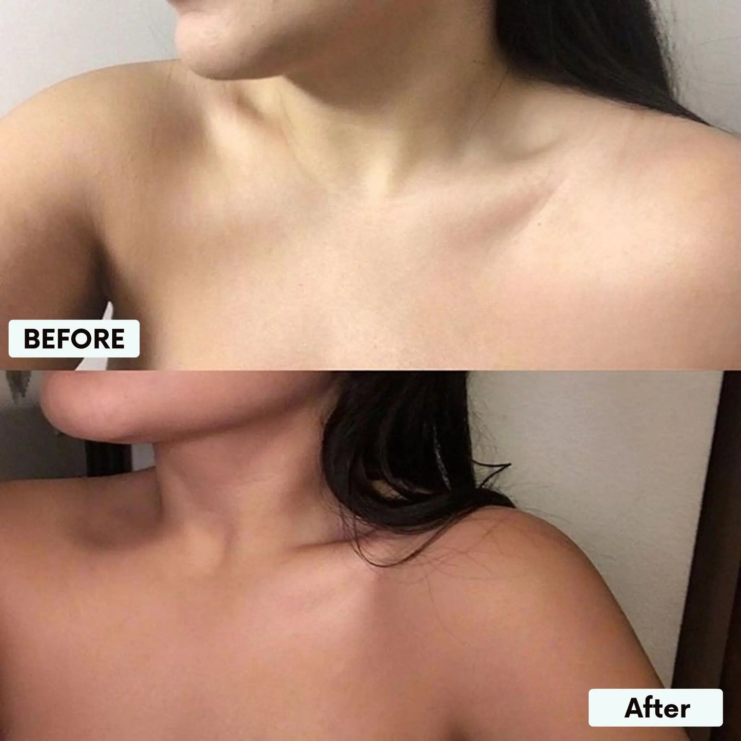 Elsovia® Transdermal Tanning Patch